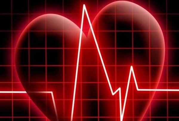 Doença Arterial Coronariana